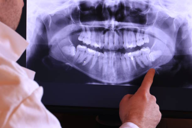 Best Broken or Cracked Tooth Emergency Dentist in North Little Rock, AR