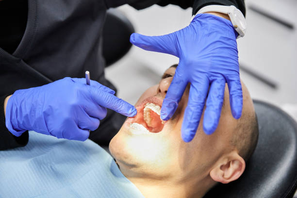 Best Emergency Dentist for Lost Fillings or Crowns in North Little Rock, AR